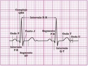 Electrocardiograma Con Interpretación