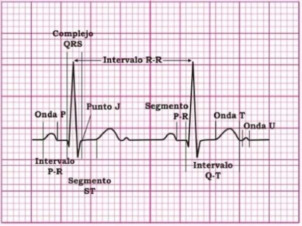 Electrocardiograma Con Interpretación